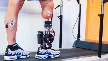 Researchers develop bionic foot that restores a natural walking pattern